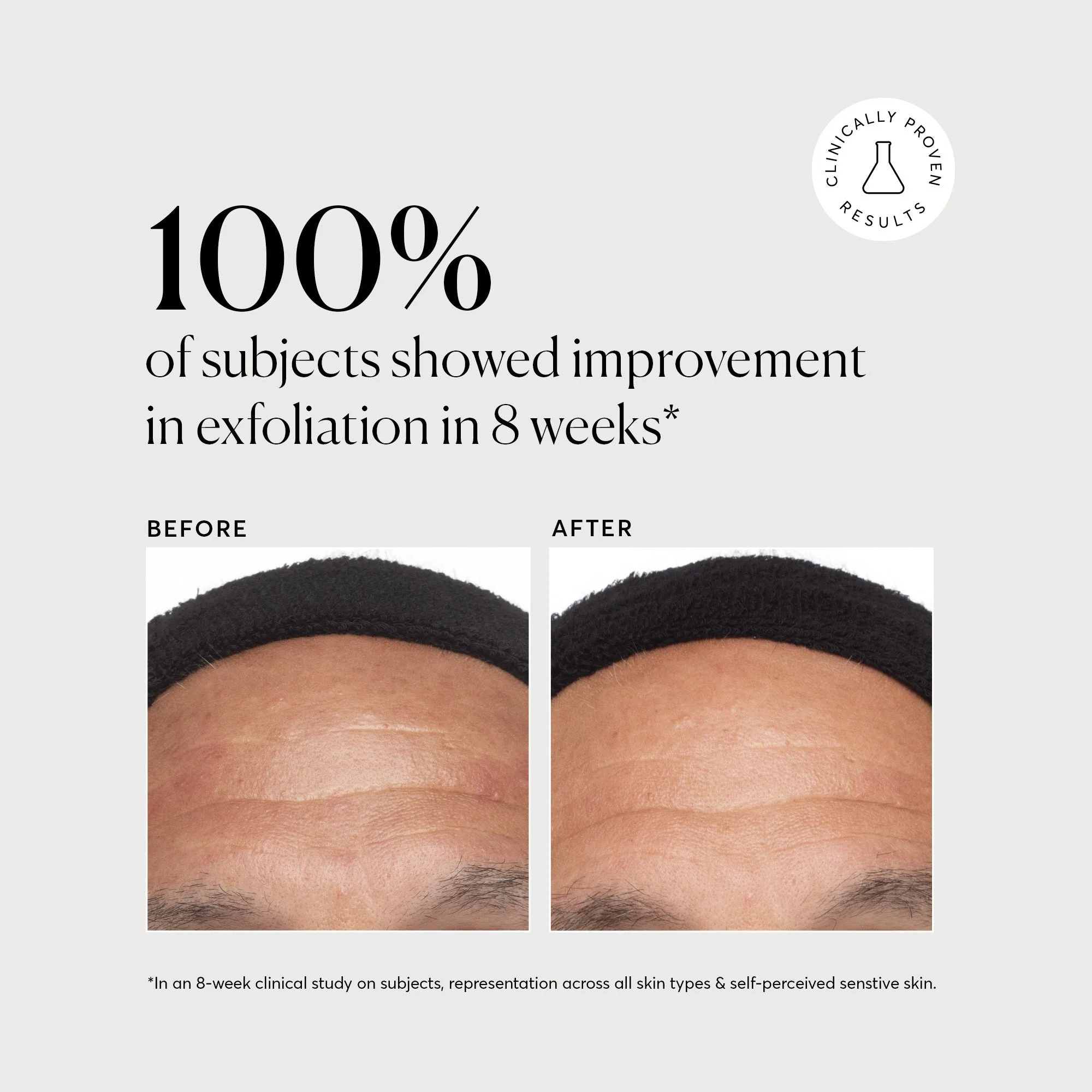 Azelaic Topical Acid 10% - Image 4