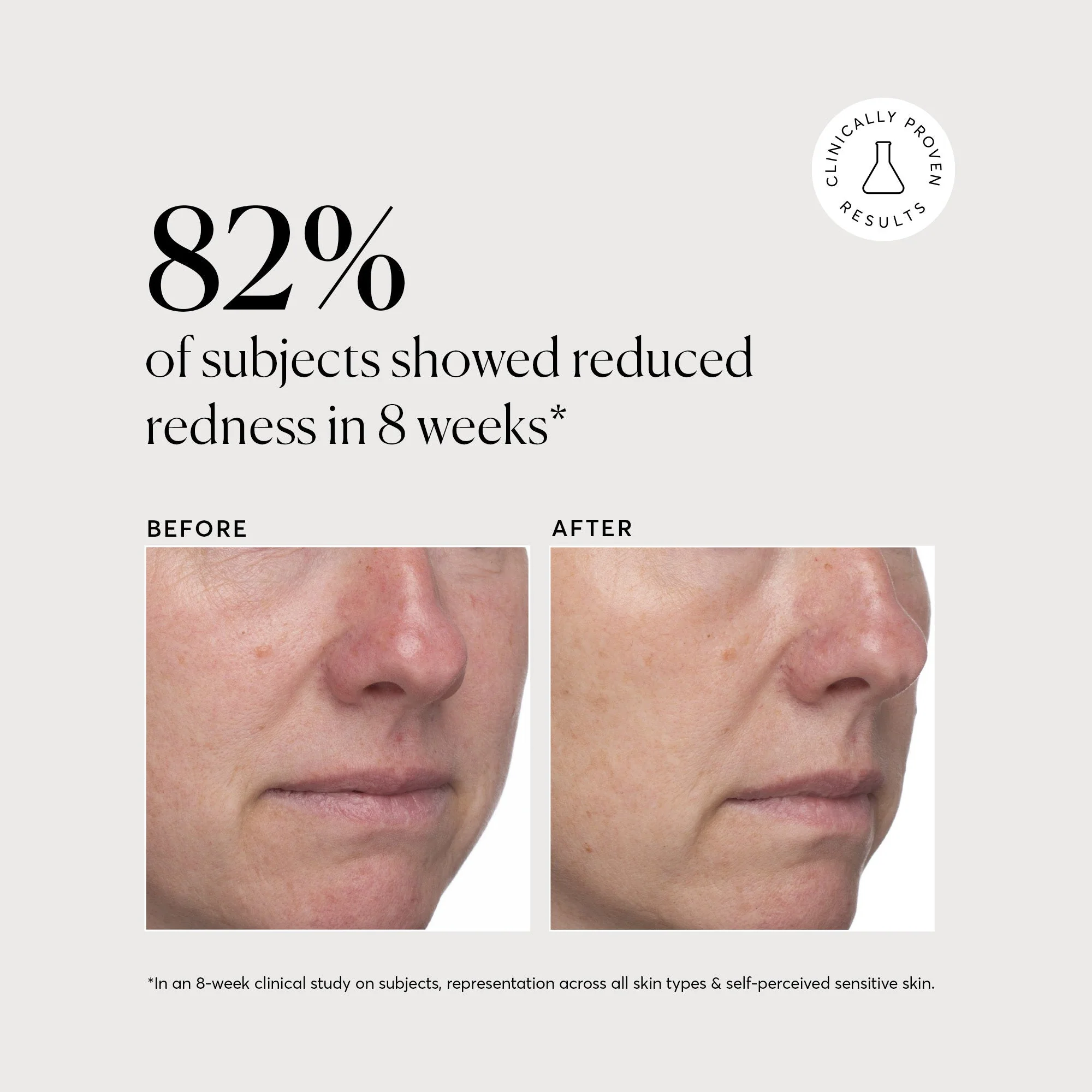 Azelaic Topical Acid 10% - Image 6