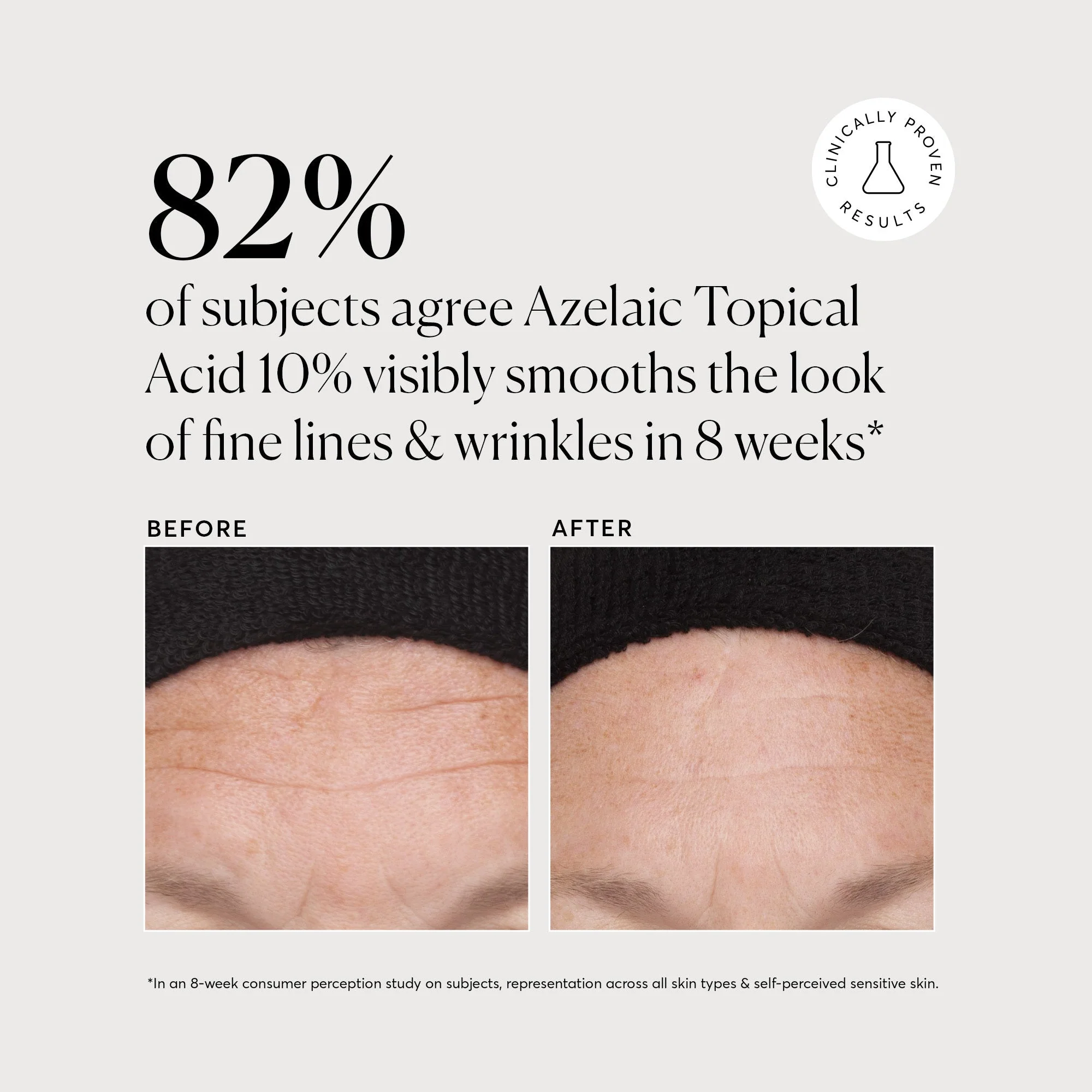 Azelaic Topical Acid 10% - Jumbo - Image 5