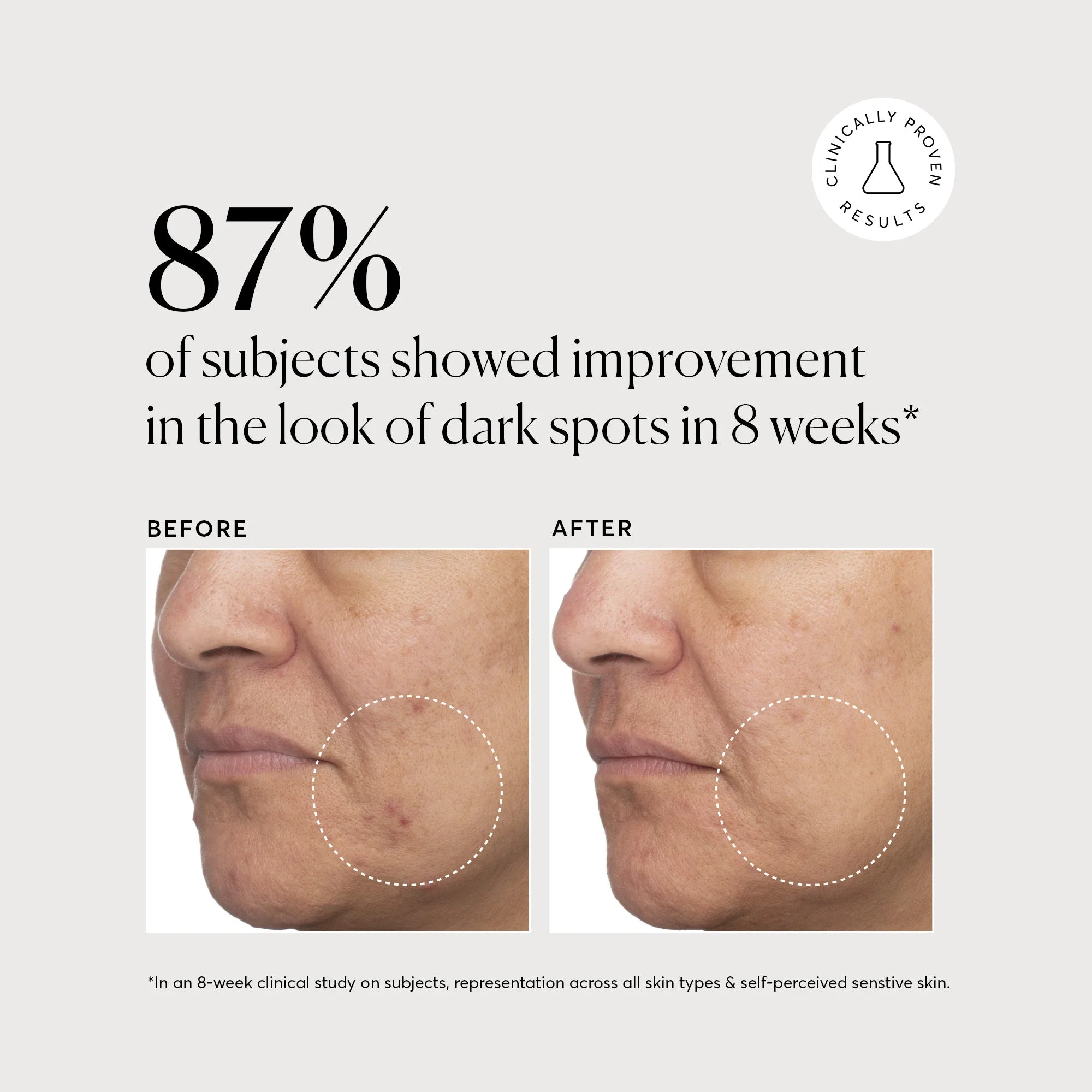 Tranexamic Topical Acid 5% - Image 3